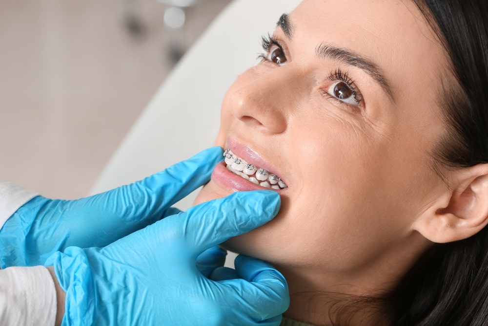Utiliser les accessoires adaptés au port d’appareil dentaire